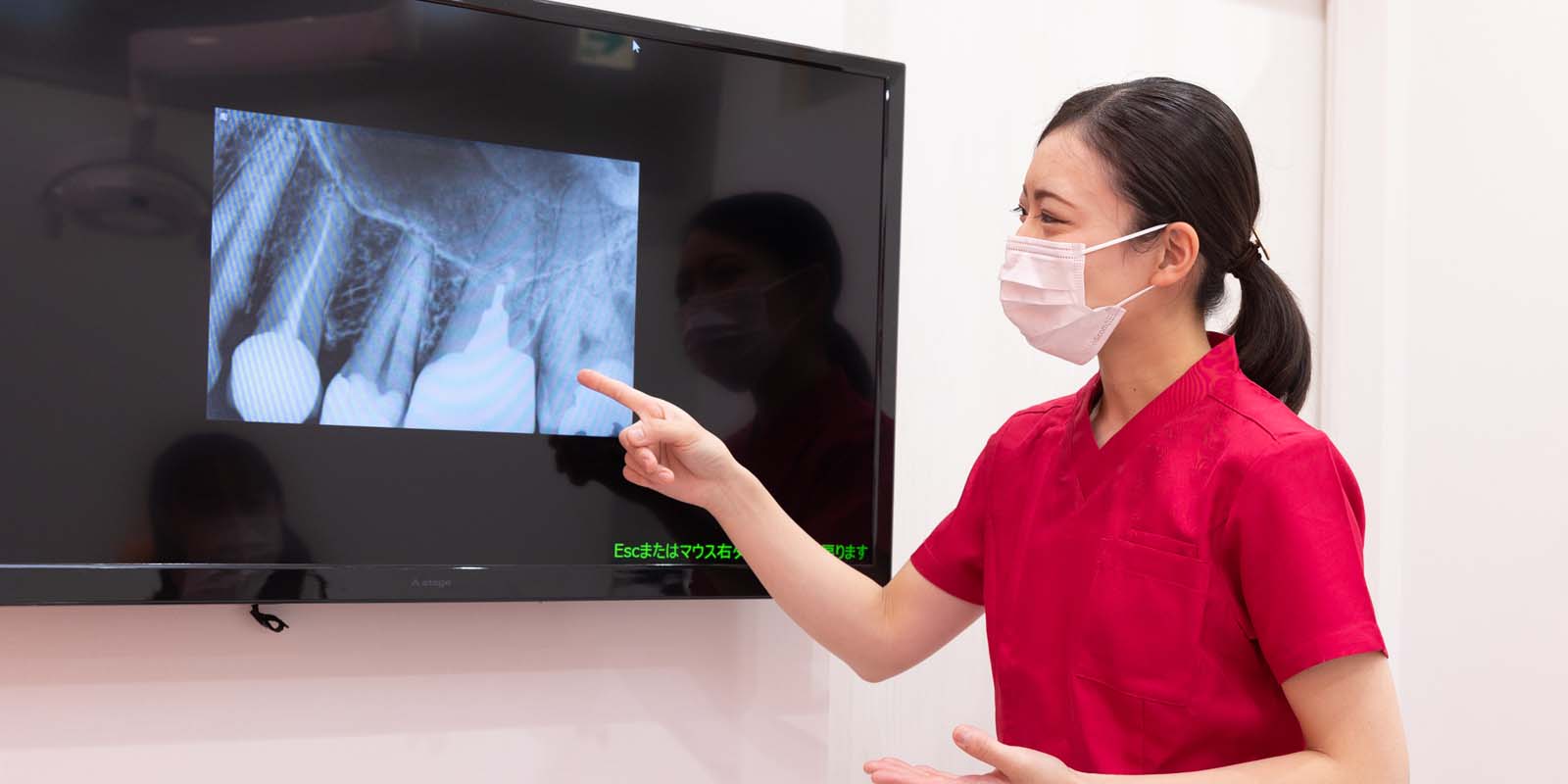 虫歯の予防法について