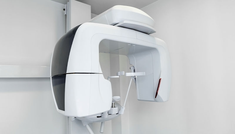 C1：軽度のむし歯